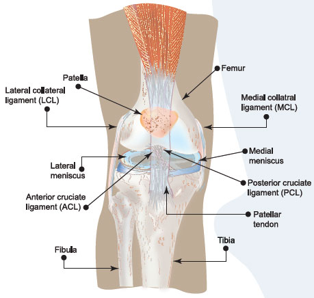 An ACL tear is usually